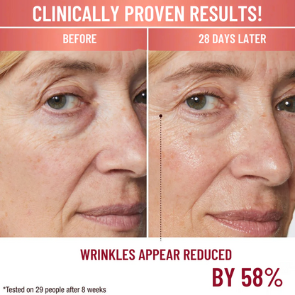 Transform Your Skin From Within Naturally